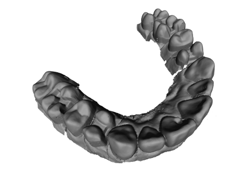 3D_tooth_2